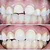 G�rsel 18