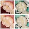 G�rsel 5