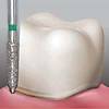 G�rsel 1