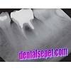 G�rsel 7