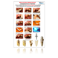 Fibersite Koronal Morfoloji Rekonstruksiyonu in Cam Fiber Sistemi Refill ( 10 Lu )