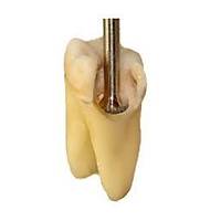 Fibersite Koronal Morfoloji Rekonstruksiyonu in Cam Fiber Sistemi Refill ( 10 Lu )