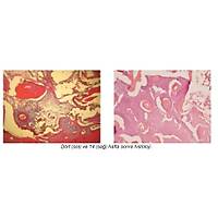 Hypro- Oss ALMANYA 3 cc Greft - ( Partik�l b�y�kl���: 0,5 - 1,0mm)
