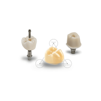 DENTSPLY SIRONA Tessera Lityum Disilikat Cad-Cam C14 Blok 4'l� Kutu