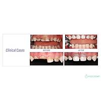 KIDS CROWN - Kids Zirconia Crown - Pediatrik Zirkonyum Krom Anterior 24 lik Set