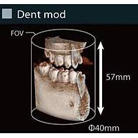 Volux9 3D Dental CT Tomografi