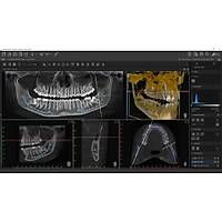 D�RR DENTAL VistaVox S Dental Volumetrik Tomografi, Panoramik R�ntgen Sistemi