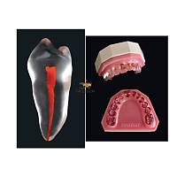 EDUDENT Endoprep E�itim Modeli Alt-�st �ene