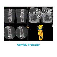 PLANMECA ProMax 3D Mid Tomografi Cihaz�