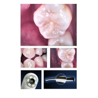 YSTAR - A��z ��i / Intra Oral Kamera