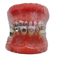 Ortodonti E�itim Modeli