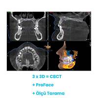 PLANMECA ProMax 3D Mid Tomografi Cihazý
