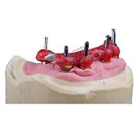 MDCLUS LC Resin Pattern Rezin 14 gr