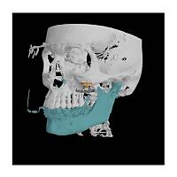 PLANMECA ProMax 3D Max Tomografi Cihazý