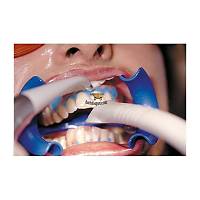 SCHUTZ / MANI DENTAL Bleach N Smile Automix Ofis Tipi Beyazlatma