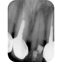 APIXIA RVG - DJTAL GRNTLEME