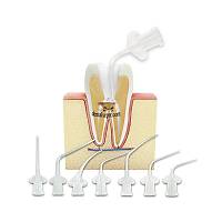 CERKAMED Elastic Applicators - Elastik Uygulama Ucu