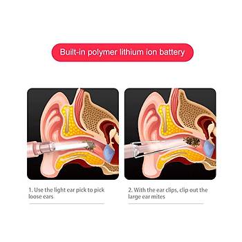 Dijital Kulak Temizleme USB Endoskop Kamera Mikro USB-C Android Windows