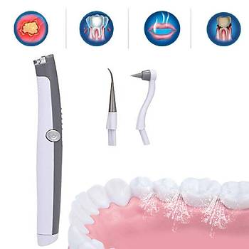 Yumuşak Ultrasonik Diş Temizleme Led Işıklı Tartar ve Leke Çıkarma 3000 Pulse