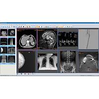 TMYPACS CD/DVD Robot Yazlm 