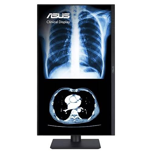 Asus MH2441A 23.8 inch 2560x1140 5ms 75Hz 3.6MP HDMI DP USB-C Otomatik Kalibrasyon Klinik Monit�r�