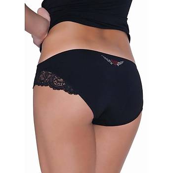 X-Lady 1533 Bayan Bikini Klot