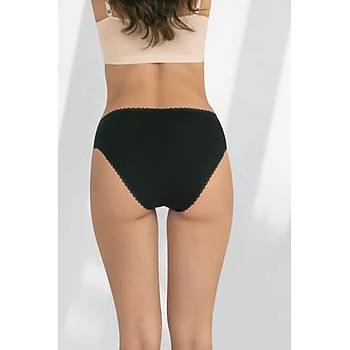 Fabony Bayan Dantelli Bikini Klot 1170
