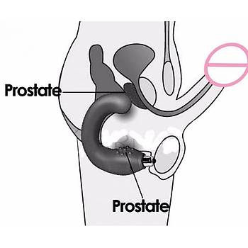 Prostat ve Testis Uyarcl G_Spot Titreimli Anal Vibratr, Masaj Stimlatr - rn Kodu: B1125