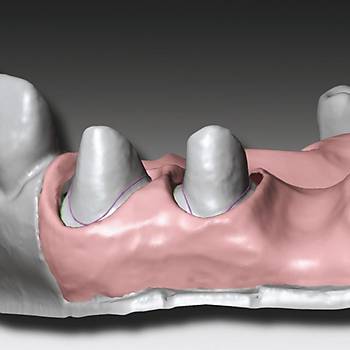 Zhermack Gingifast Rigid Cad Cam ��in Di� Eti Maskesi Sert