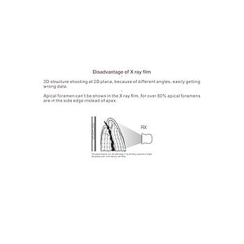 Woodpecker Woodpex III Gold Apex Locater