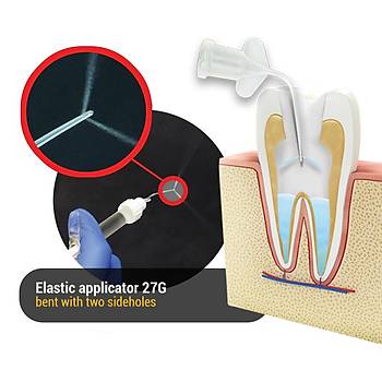 Cerkamed Elastic Applicators Elastik Uygulama Ucu