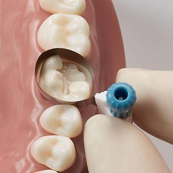 Dentsply Palodent 360 evresel Matrix Sistemi Refill