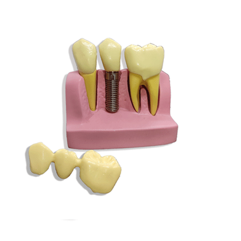 �da Collection �mplant Modeli