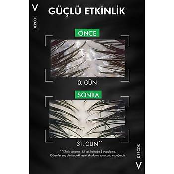Vchy Dercos Hasas Sa Derisi Kepek Kart amp.