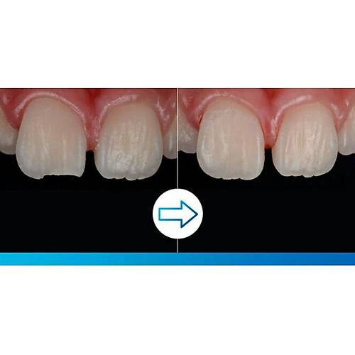 3M™ Filtek™ Supreme Flowable Restoratif Refill Şırınga A3 Shade , 3930A3