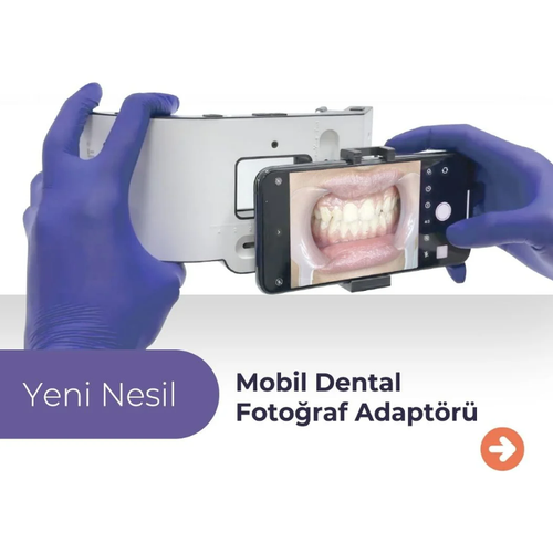 EIGHTEETH Ultra X - Ultrasonik Irigasyon Aktivasyon Cihaz - XPEDENT MOBL DENTAL FOTORAF ADAPTR HEDYEL