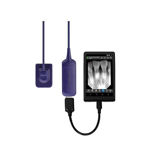 Youjoy Tablet Ekranl� RVG + Hasta Takip Yaz�l�m� � 1 Y�l Garantili
