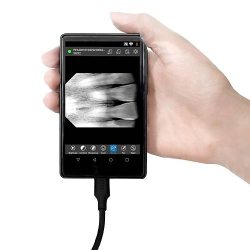 Youjoy Tablet Ekranl� RVG + Hasta Takip Yaz�l�m� � 1 Y�l Garantili