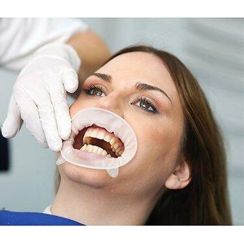 Ivoclar OptraGate Dudak Yanak Ekart�r� Regular / Small