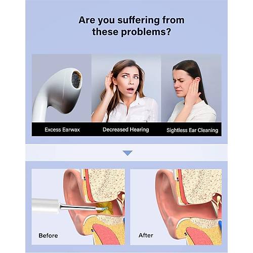 BEBIRD T5 3MP KAMERA 3.5MM LENS �ARJLI WIFI G�R�NT�L� KULAK TEM�ZLEY�C� BEYAZ RENK