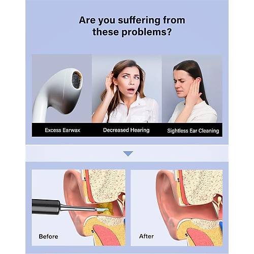 BEBIRD T5 3MP KAMERA 3.5MM LENS �ARJLI WIFI G�R�NT�L� KULAK TEM�ZLEY�C� S�YAH RENK