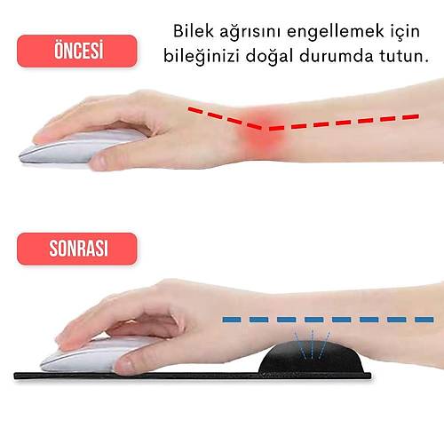 Siyah Bilek Destekli Ergonomik Jel Kaymaz Taban Mouse Pad