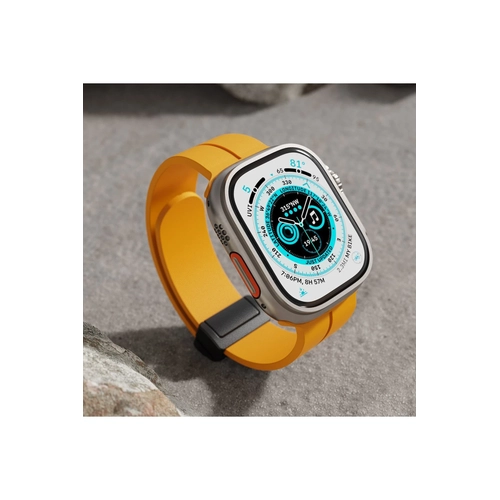 Newface Apple Watch 38mm KR412 Elegance Stylsh Kordon - Koyu Yeil