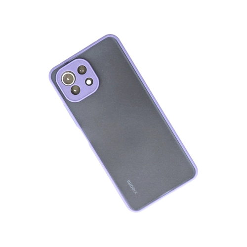 Newface Xiaomi M 11 Lite Klf Montreal Silikon Kapak - Mor