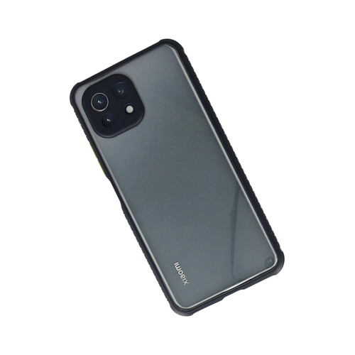 Newface Xiaomi M 11 Lite Klf Miami effaf Silikon - Lacivert