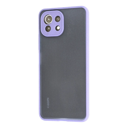 Newface Xiaomi M 11 Lite Klf Montreal Silikon Kapak - Mor