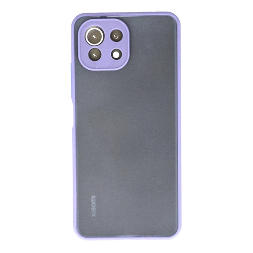 Newface Xiaomi M 11 Lite Klf Montreal Silikon Kapak - Mor
