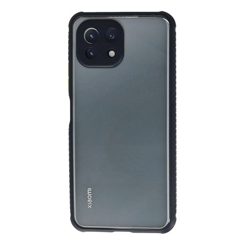 Newface Xiaomi M 11 Lite Klf Miami effaf Silikon - Lacivert