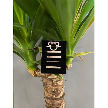 Apple Watch Uyumlu Kordon Aksesuar� Charm Set Mickey