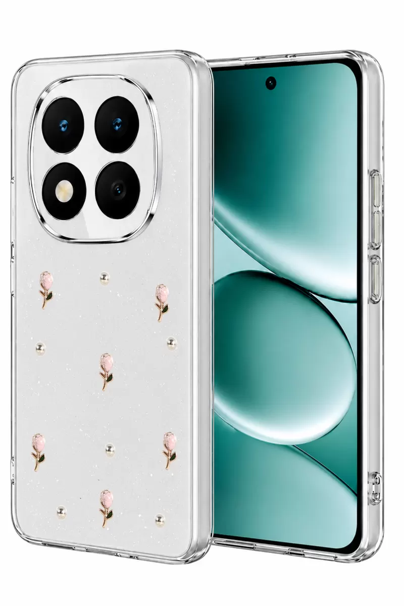 Note 15 4G Fiyonk Desenli Kapak - Desen 6